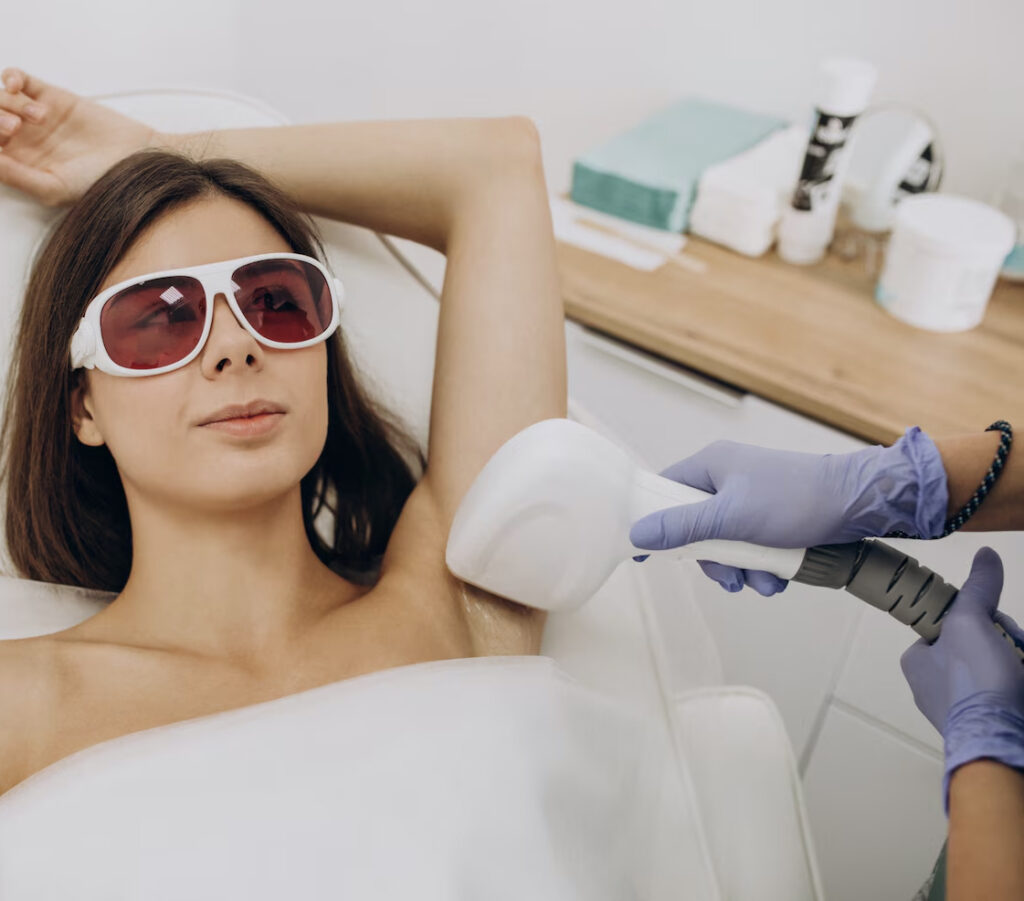 Laser hair removal treatments