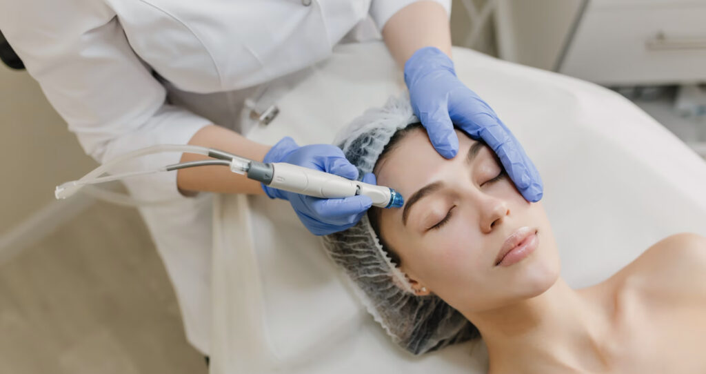 Aesthetic professional performing microneedling treatment on a woman's face, promoting skin rejuvenation and collagen stimulation.
