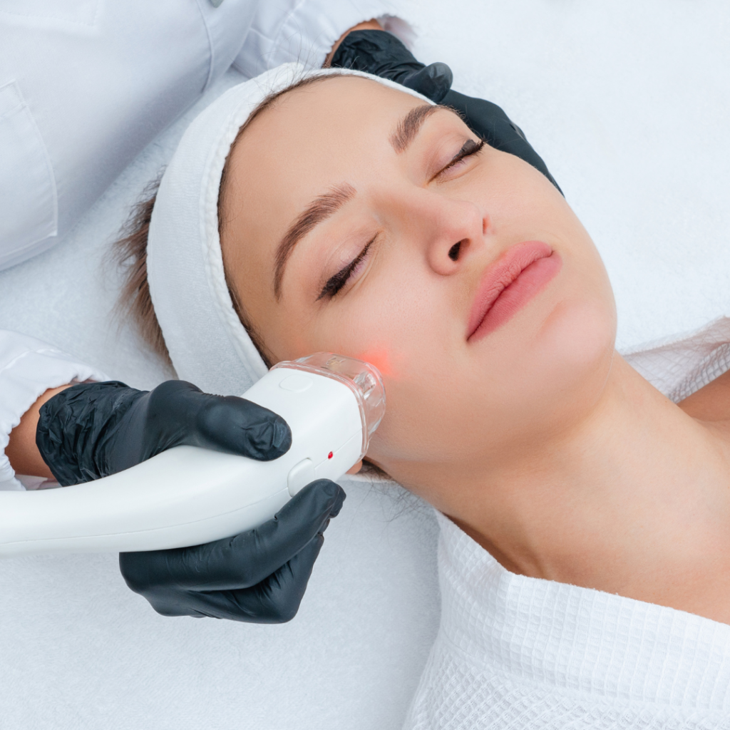 Woman receiving microneedling treatment with a handheld device on her face, performed by a professional in a clinical setting, highlighting skin rejuvenation and collagen stimulation.