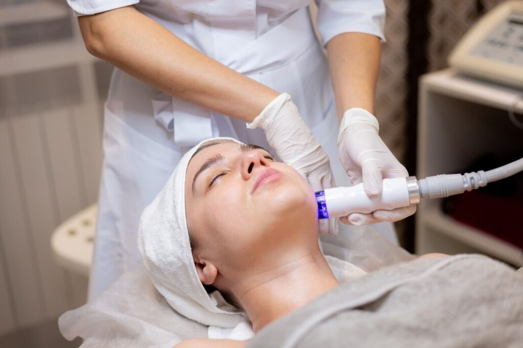 microneedling